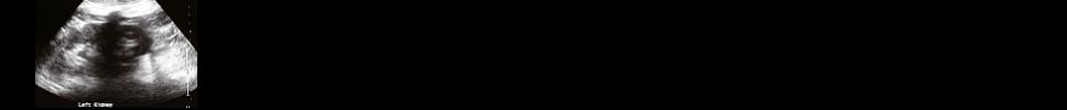 us banner